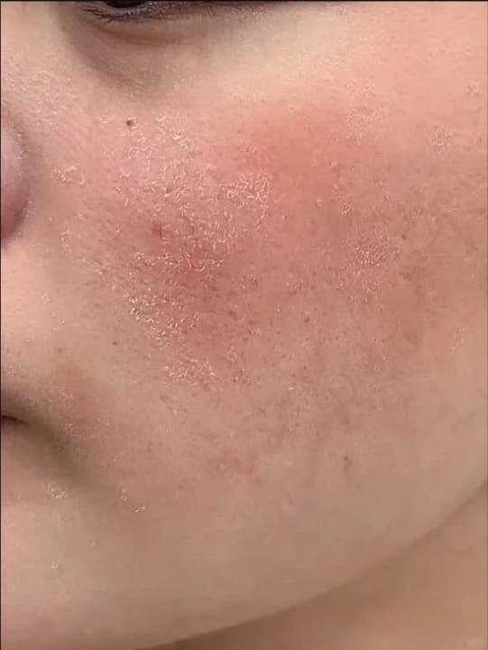 Dry, red and flaky skin