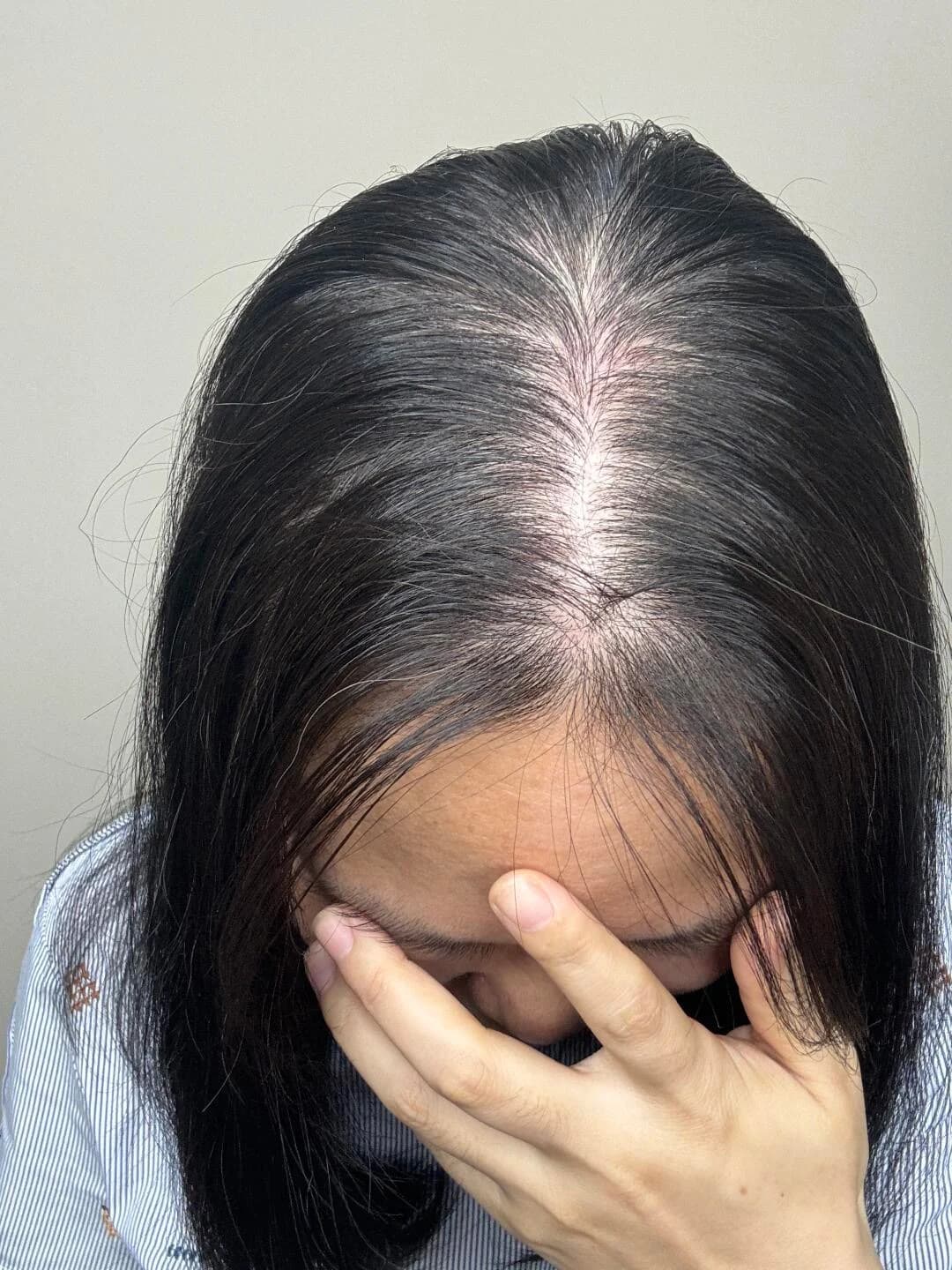 Thinning hair and scalp concerns