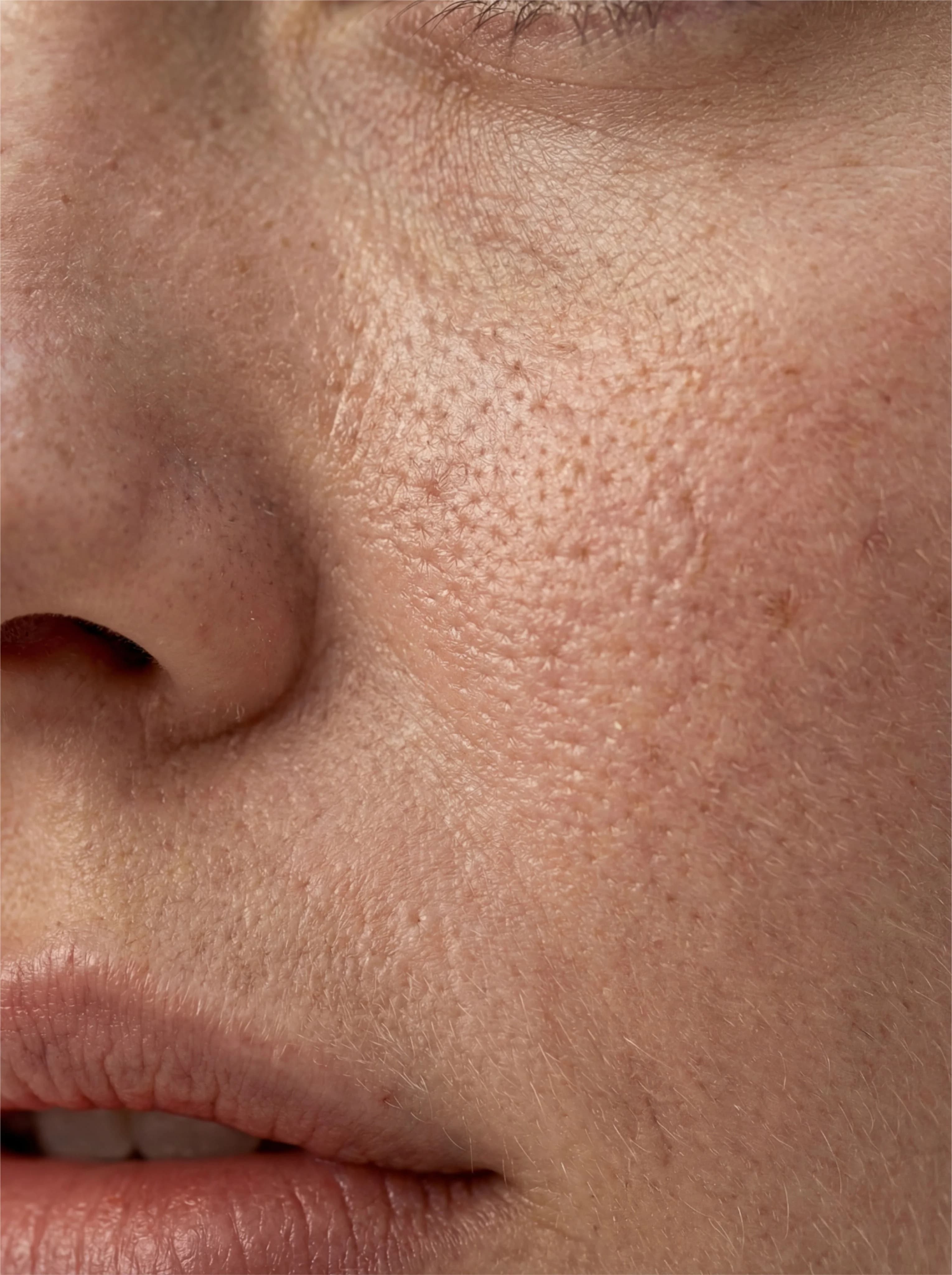 Visible pores and uneven skin texture