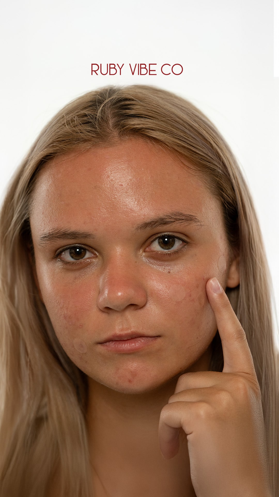 A portrait of a woman with skin imperfections, highlighting the need for a must-have cleanser to achieve a clearer complexion.