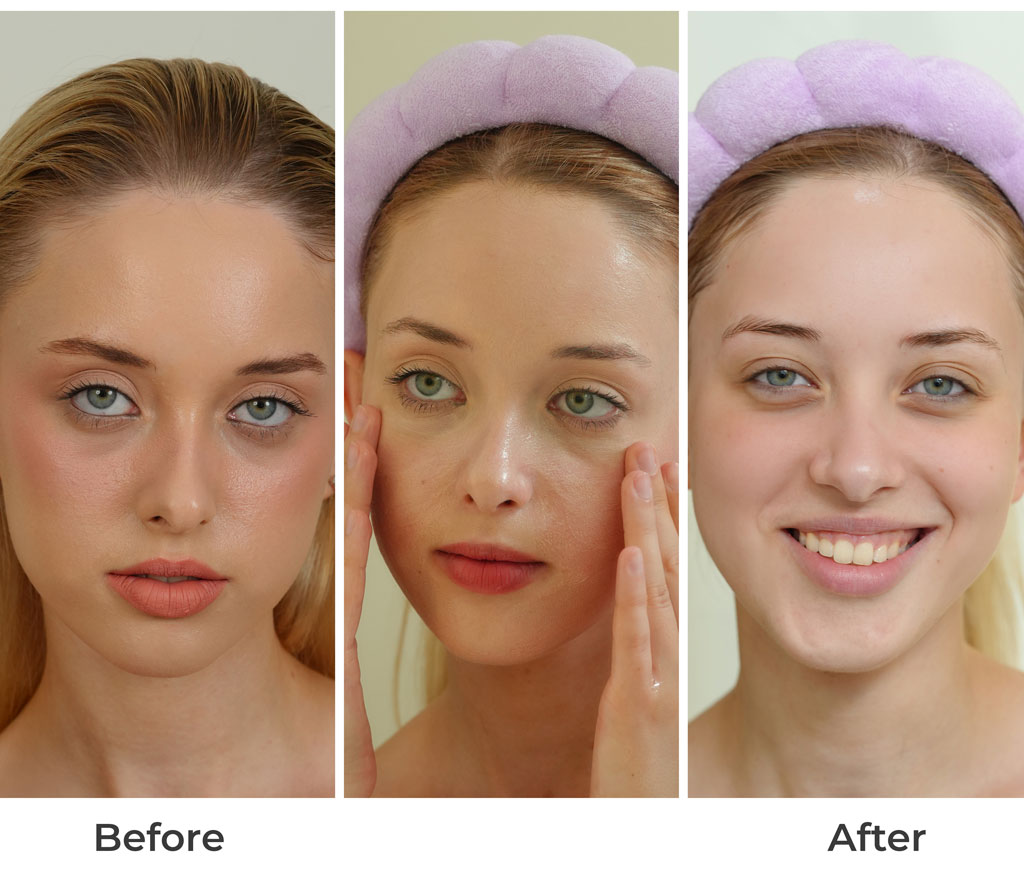 A young woman before and after comparison an oil based cleanser 