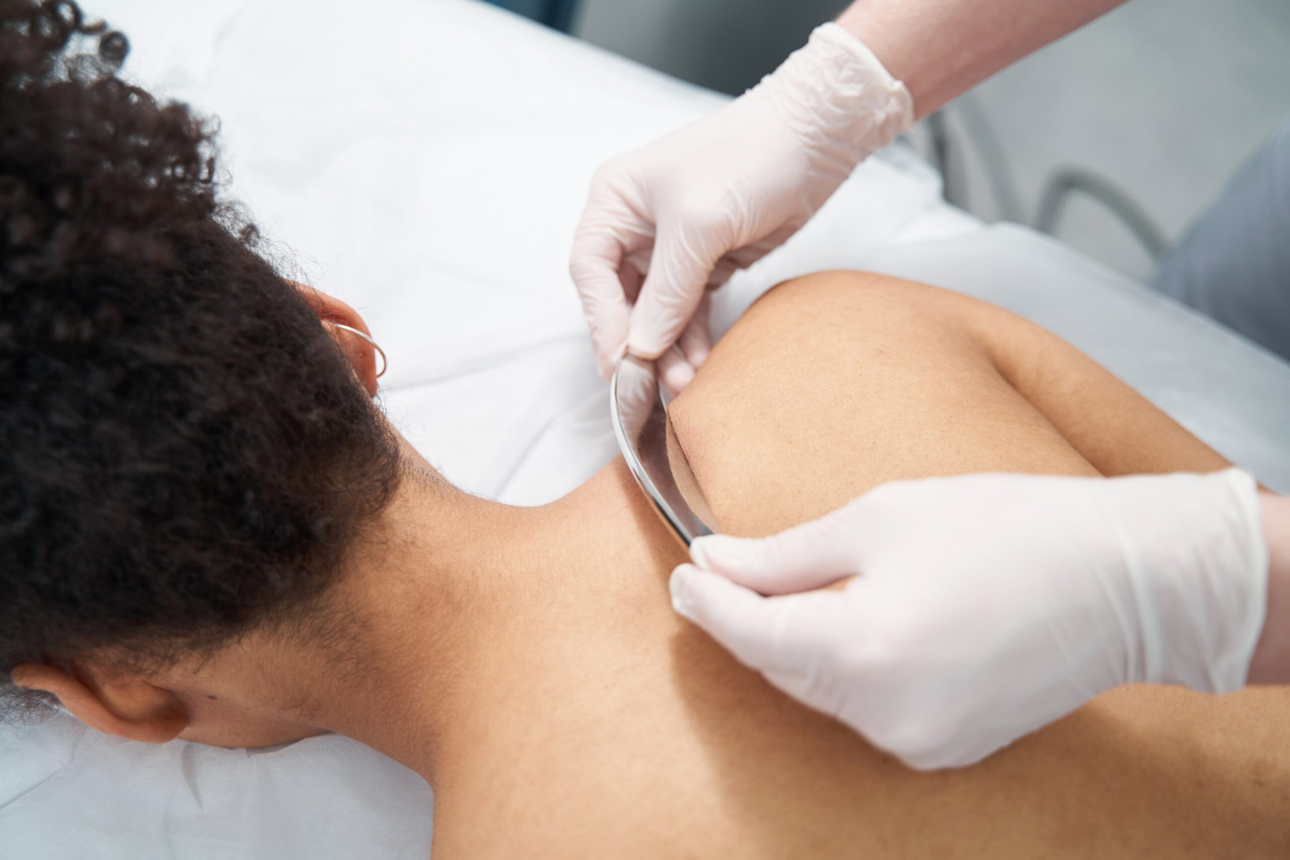 A person's back is being treated with a professional skincare tool by gloved hands, demonstrating a step in a back acne treatment routine.