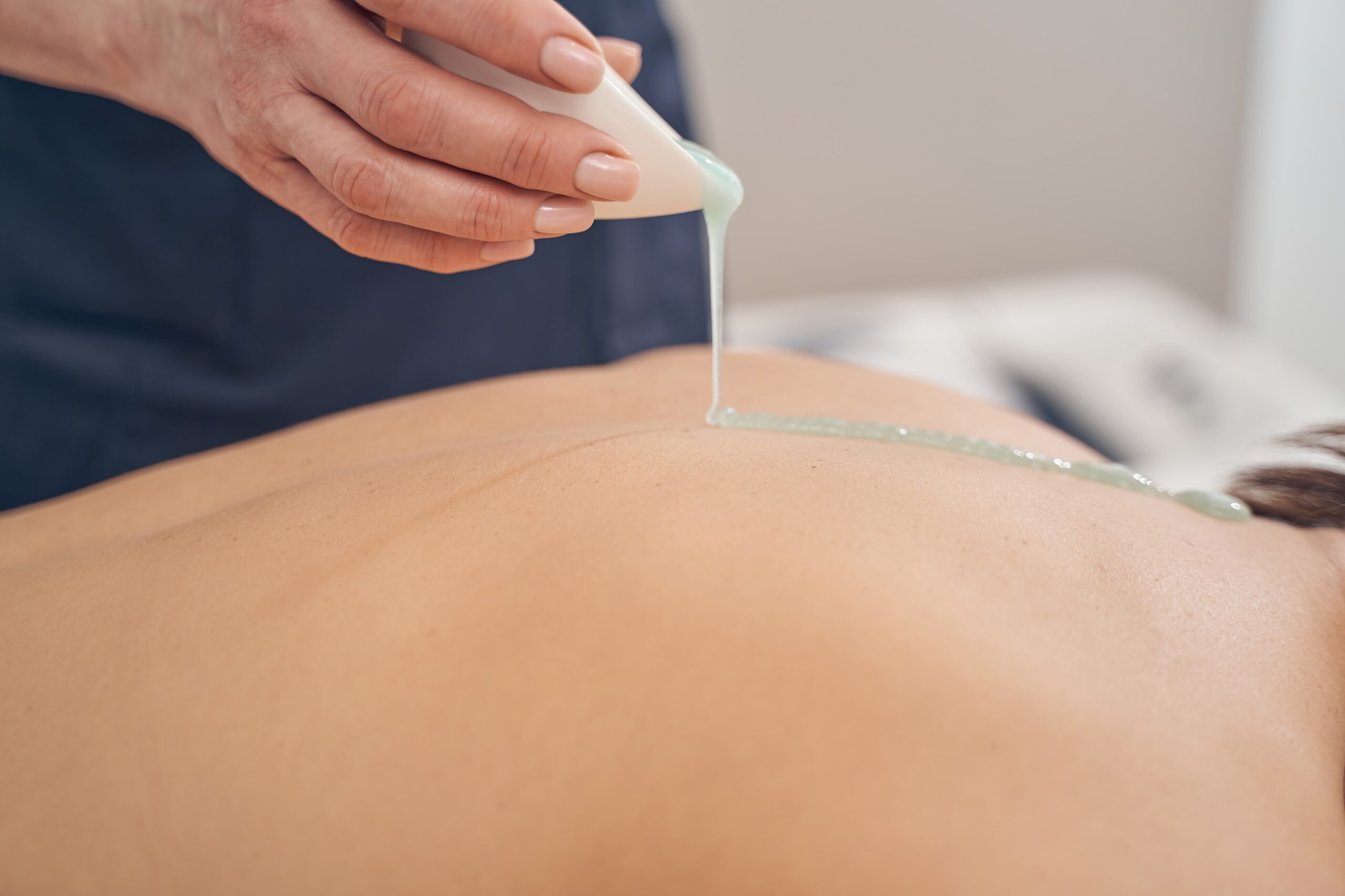 A professional applies a light blue gel treatment to a person's back, representing the application of a product for a back acne treatment routine.