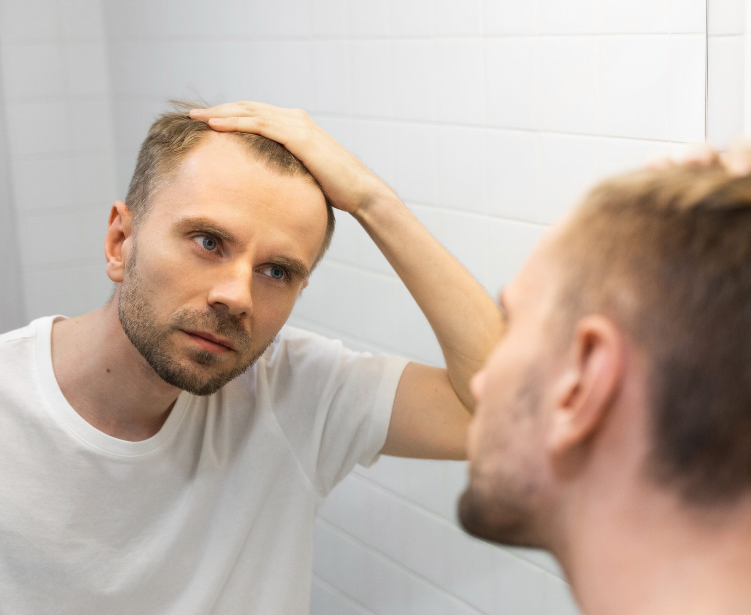 A concerned man looks at his thinning hairline in a bathroom mirror, illustrating the emotional impact of hair loss and the search for effective solutions.