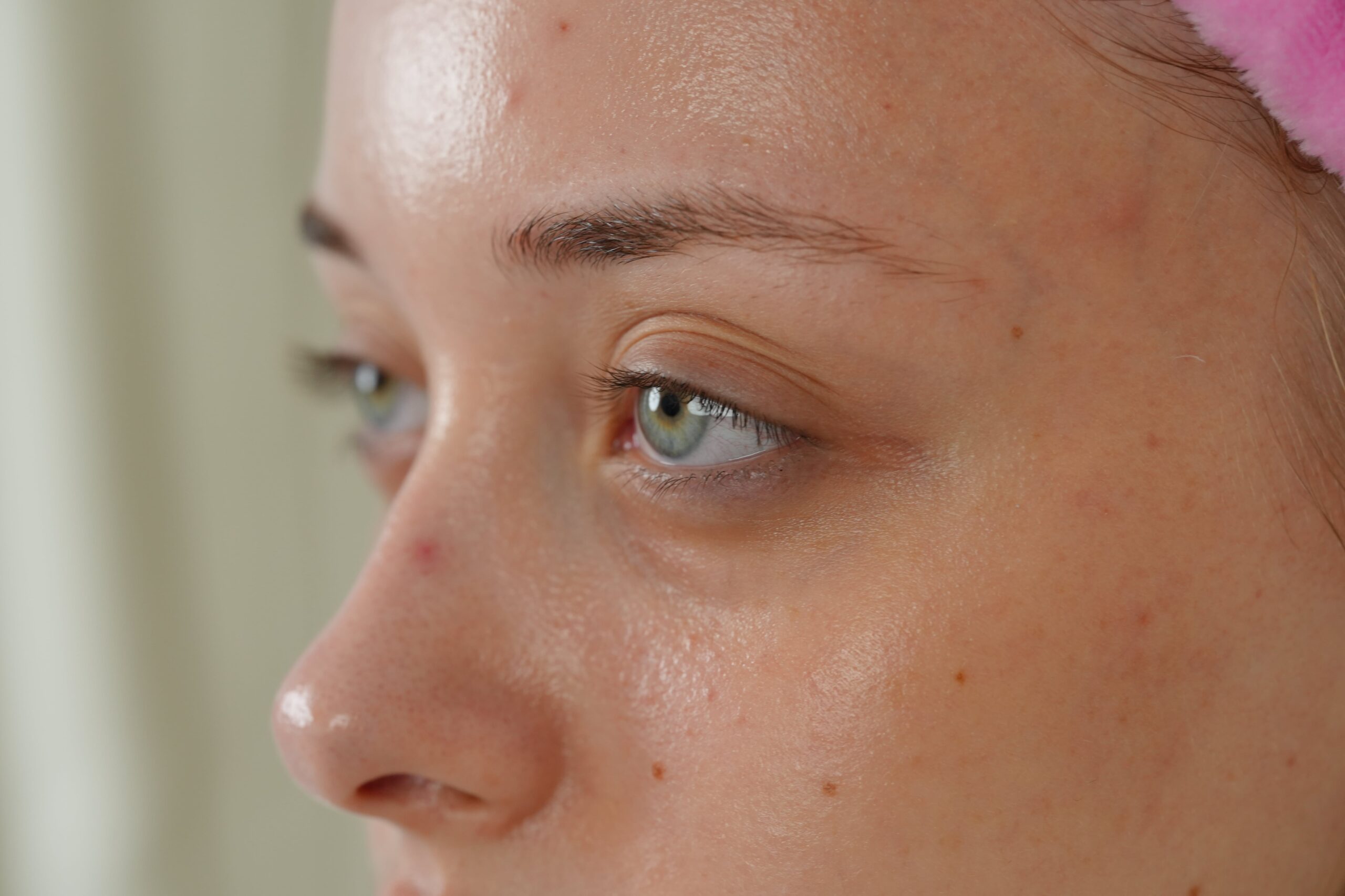 A close-up of a person's under-eye area showing visible dark circles, illustrating the common issue that makeup and skincare can address.