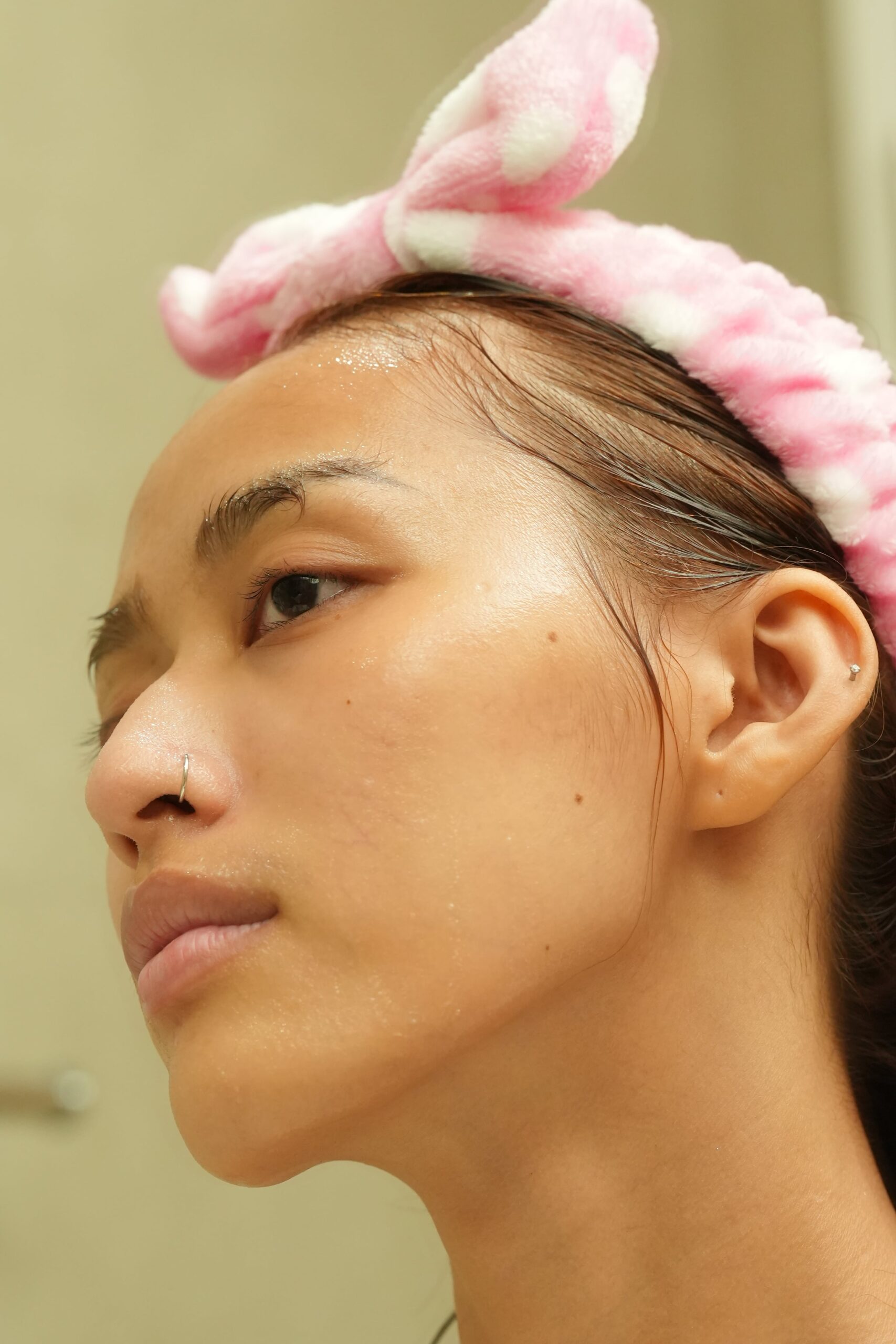 A side-view portrait showing a person's under-eye area, illustrating the common concern of dark circles before treatment.