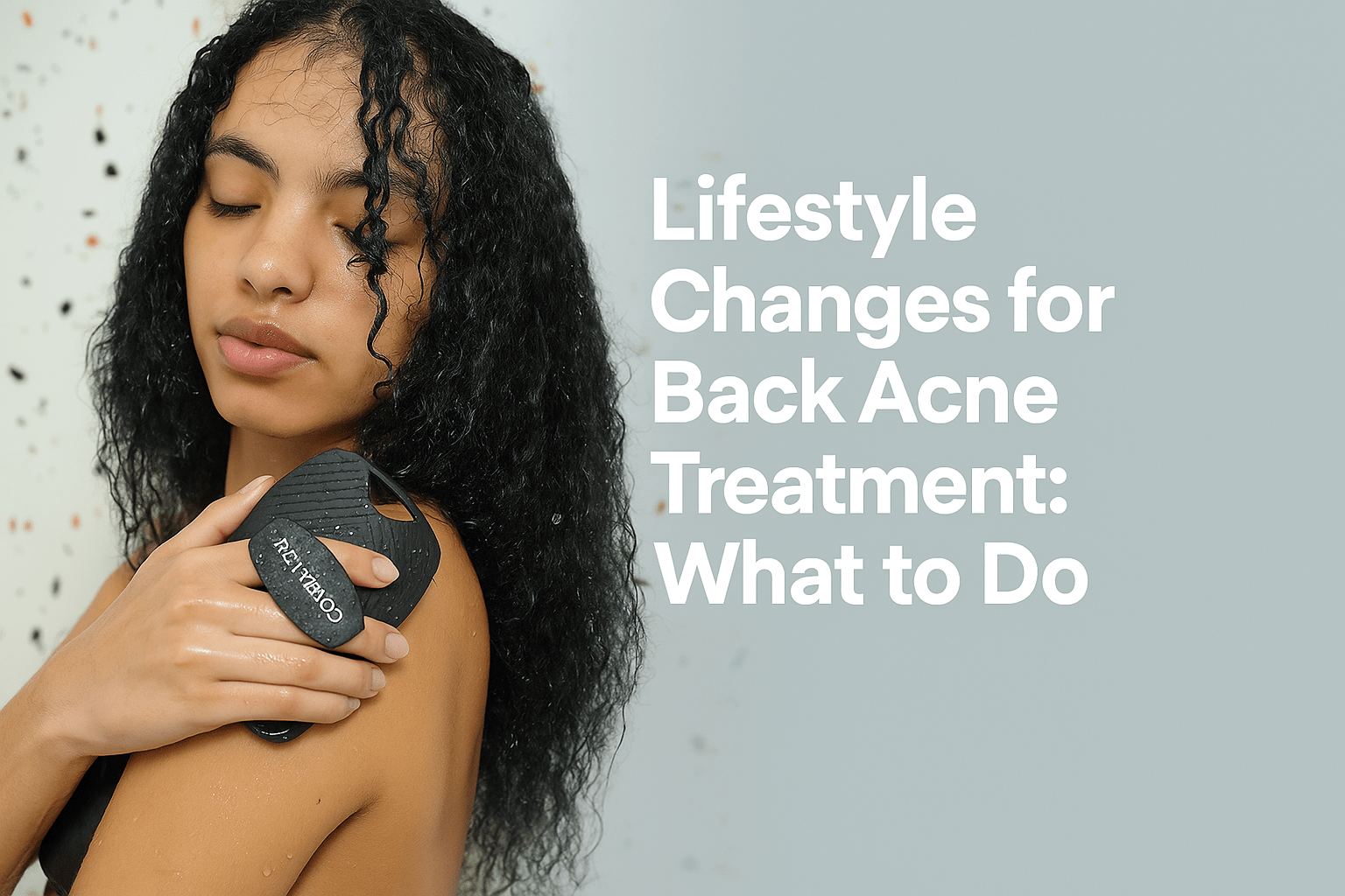 Lifestyle Changes for Back Acne Treatment: What to Do