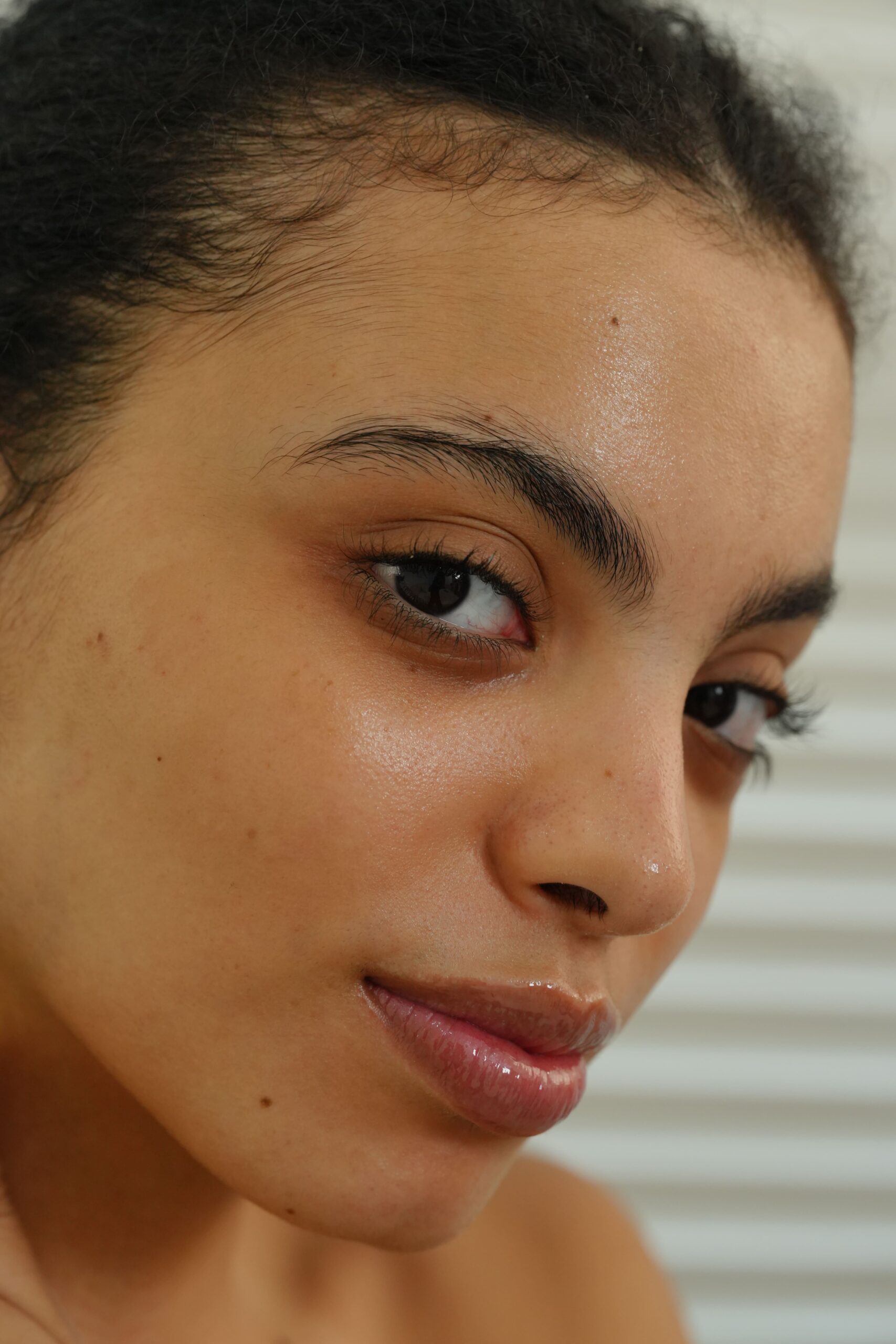 A close-up of a person's face showing under-eye darkness, illustrating the common issue that can be improved with natural lifestyle changes.