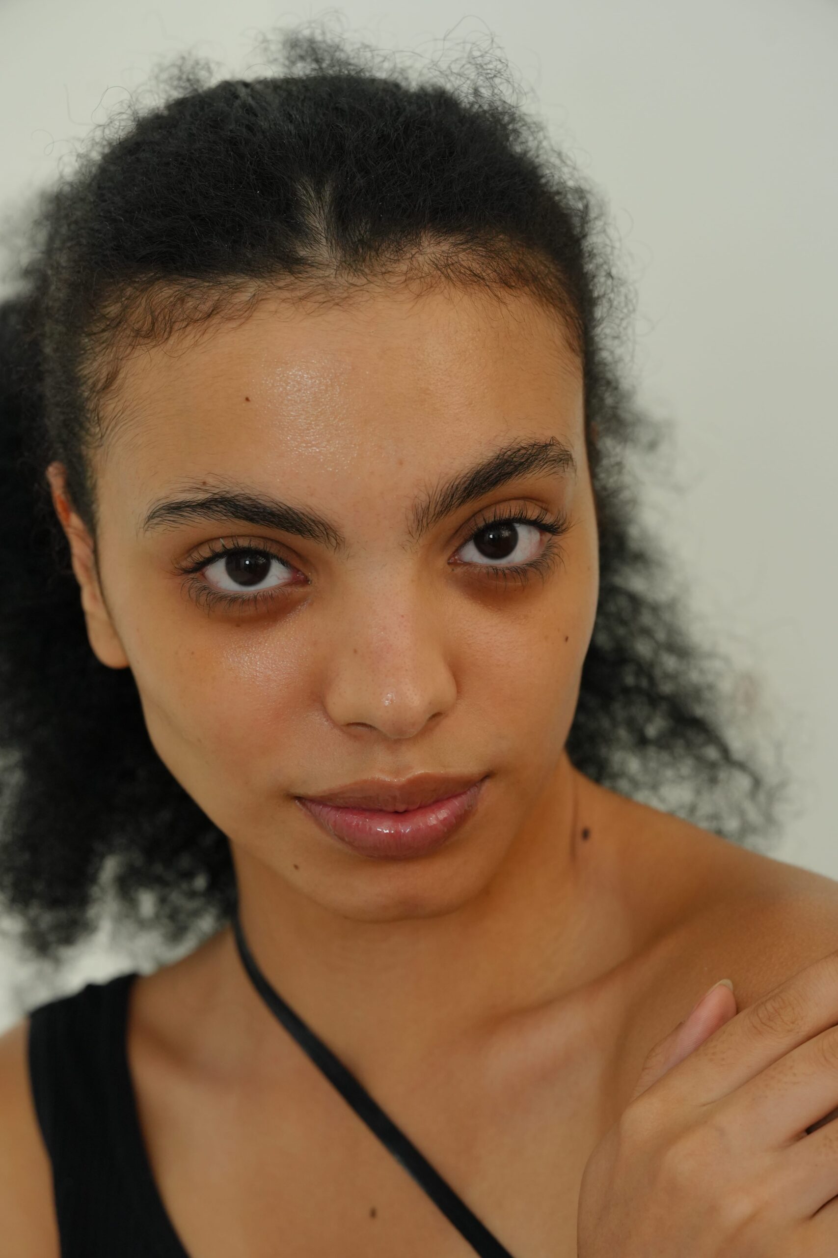 A portrait of a person with visible dark circles under their eyes, highlighting the need for lifestyle changes to naturally get rid of them.